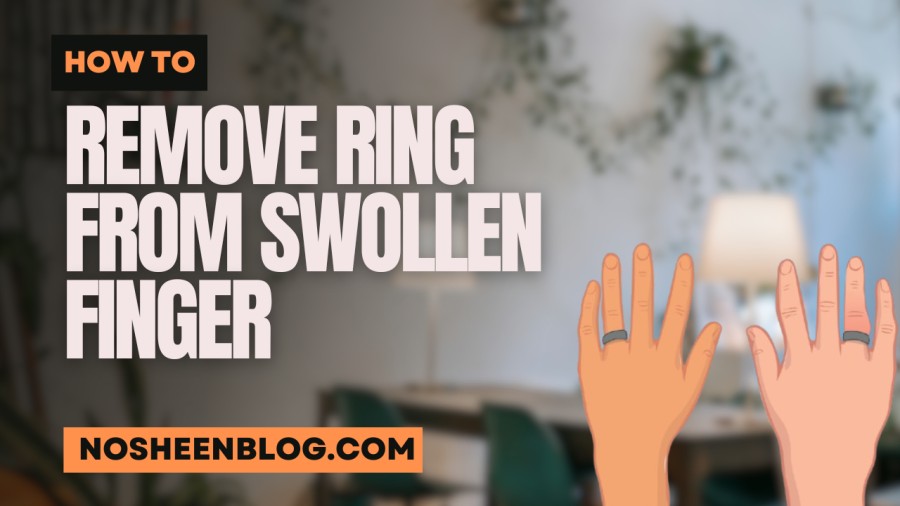 How to Get a Ring Off a Swollen Finger